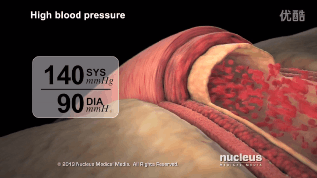 血压高于正常范围时血管的收缩.gif