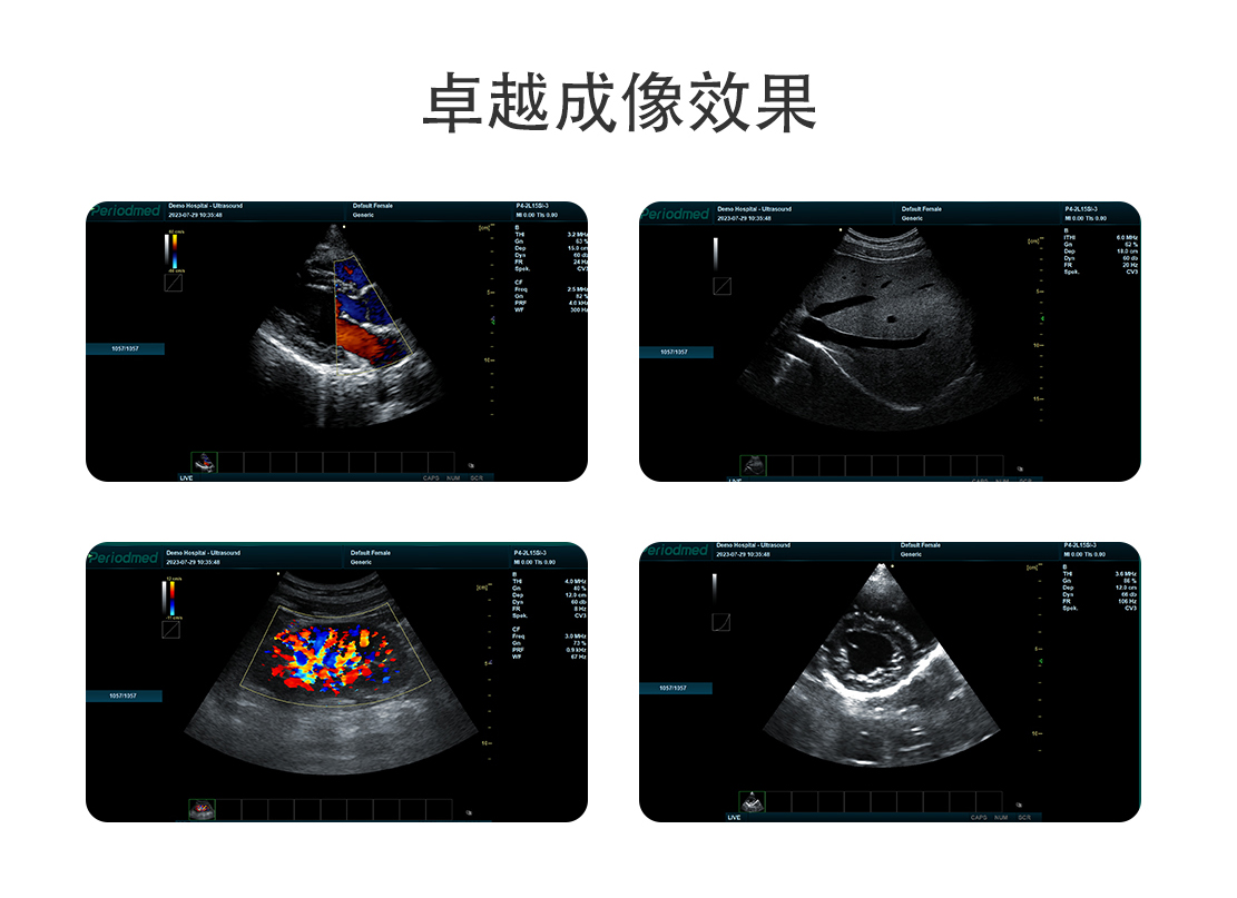 中文网站-PU-VML151A_05.jpg